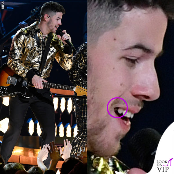 Nick Jonas sul palco con l'insalata tra i denti