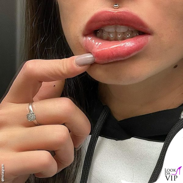 La modella mostra i diamanti sui denti inferiori