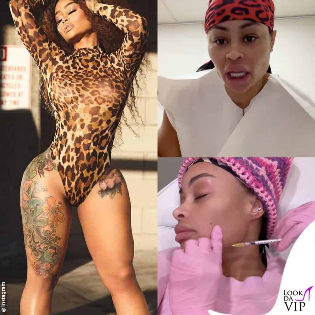 Blac Chyna rimuove le protesi al seno e i filler