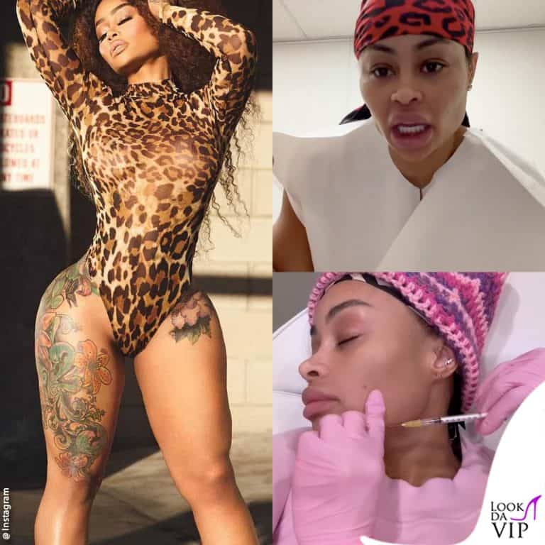 Blac Chyna rimuove le protesi al seno e i filler