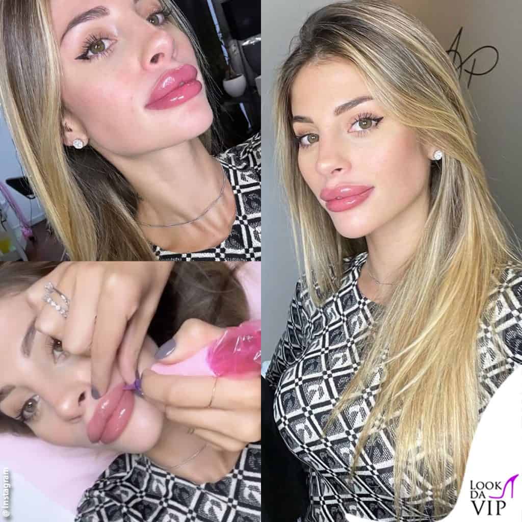 Chiara Nasti, è polemica per il tattoo sulle labbra
