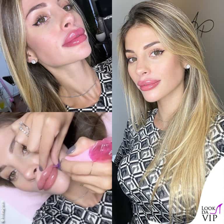 Chiara Nasti, è polemica per il tattoo sulle labbra