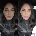 Giulia De Lellis parla dei ritocchi estetici 