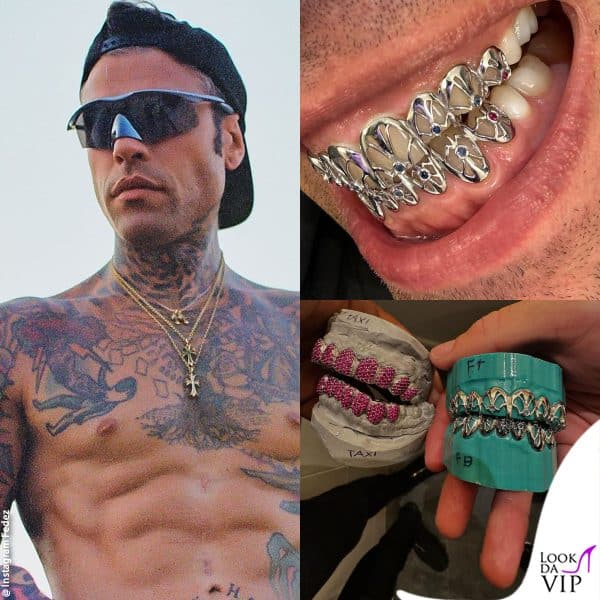 Grillz firmato Pinstripe per Fedez, di fianco al suo c'è quello del rapper Taxi B 