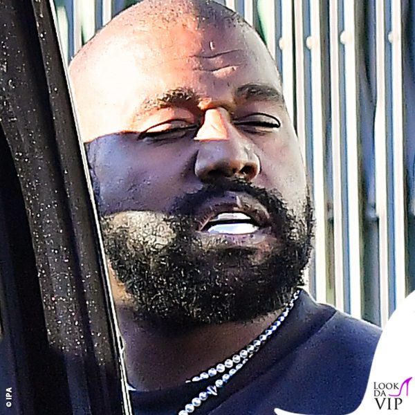 Kanye West ha fatto sostituire i denti con lastre di titanio