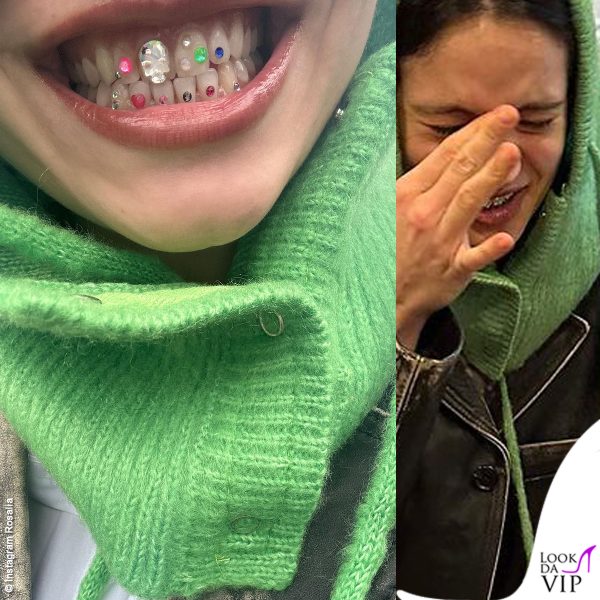 Tantissimi tooth charm rendono luminosissimo il sorriso di Rosalia