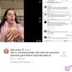Kylie Jenner svela i dettagli della protesi al seno