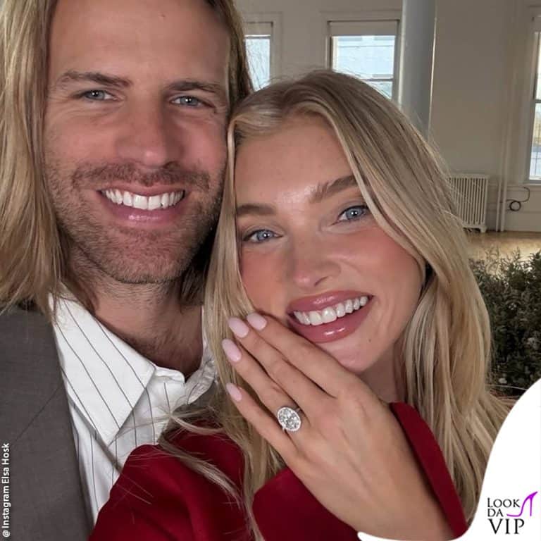 Elsa Hosk e Tom Daly si sposano: l'anello di fidanzamento è firmato Tiffany & Co.